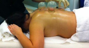 10 Best Cupping Sets For Acupuncture