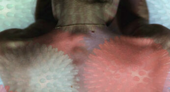 Self Myofascial Release Tools: Wellness 101