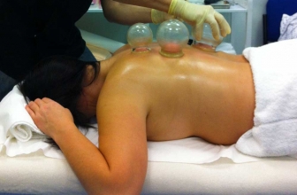 10 Best Cupping Sets For Acupuncture